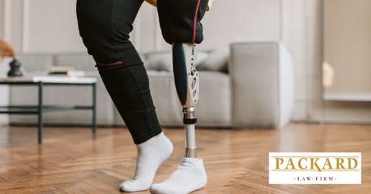 person with artificial leg